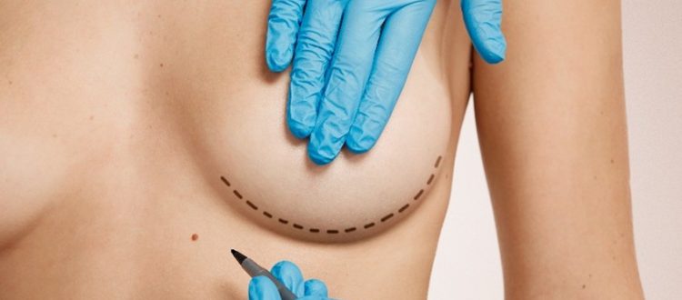 cirugia mamaria en huelva